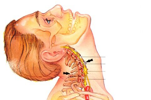 Osteocondroza cervicala: simptome si tratament, Osteochondroza și tratamentul cu unguente