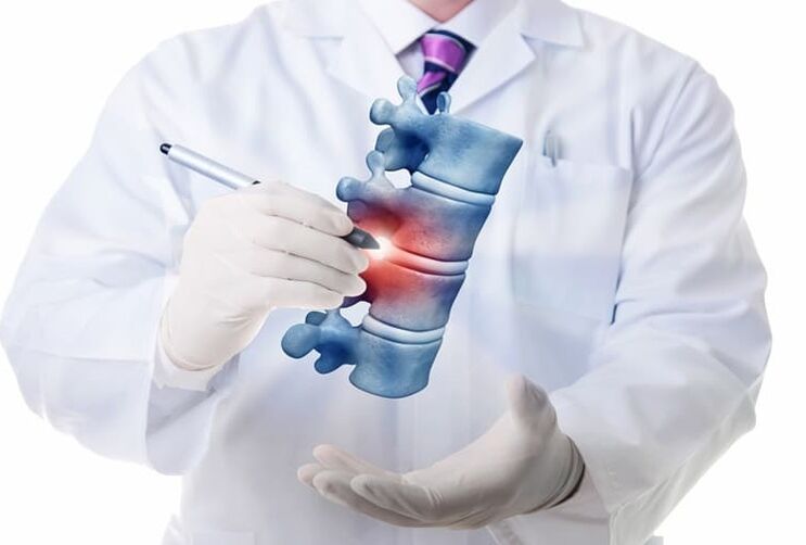 leziuni ale coloanei vertebrale datorate osteocondrozei toracice